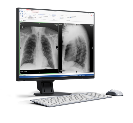 PACS-Software - PACS-Medidok-Roentgen-Software-Loesung.jpeg