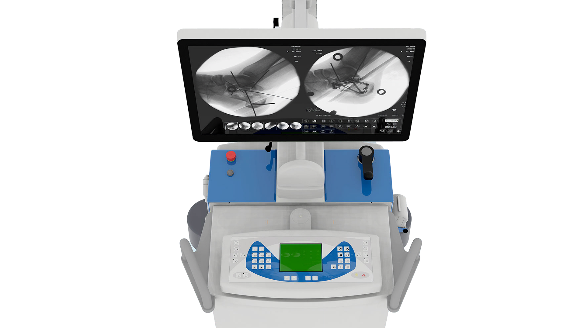 C-Bogen TCA 6 - TECHNIX-xray-equipment-TCA6-keyboard.png
