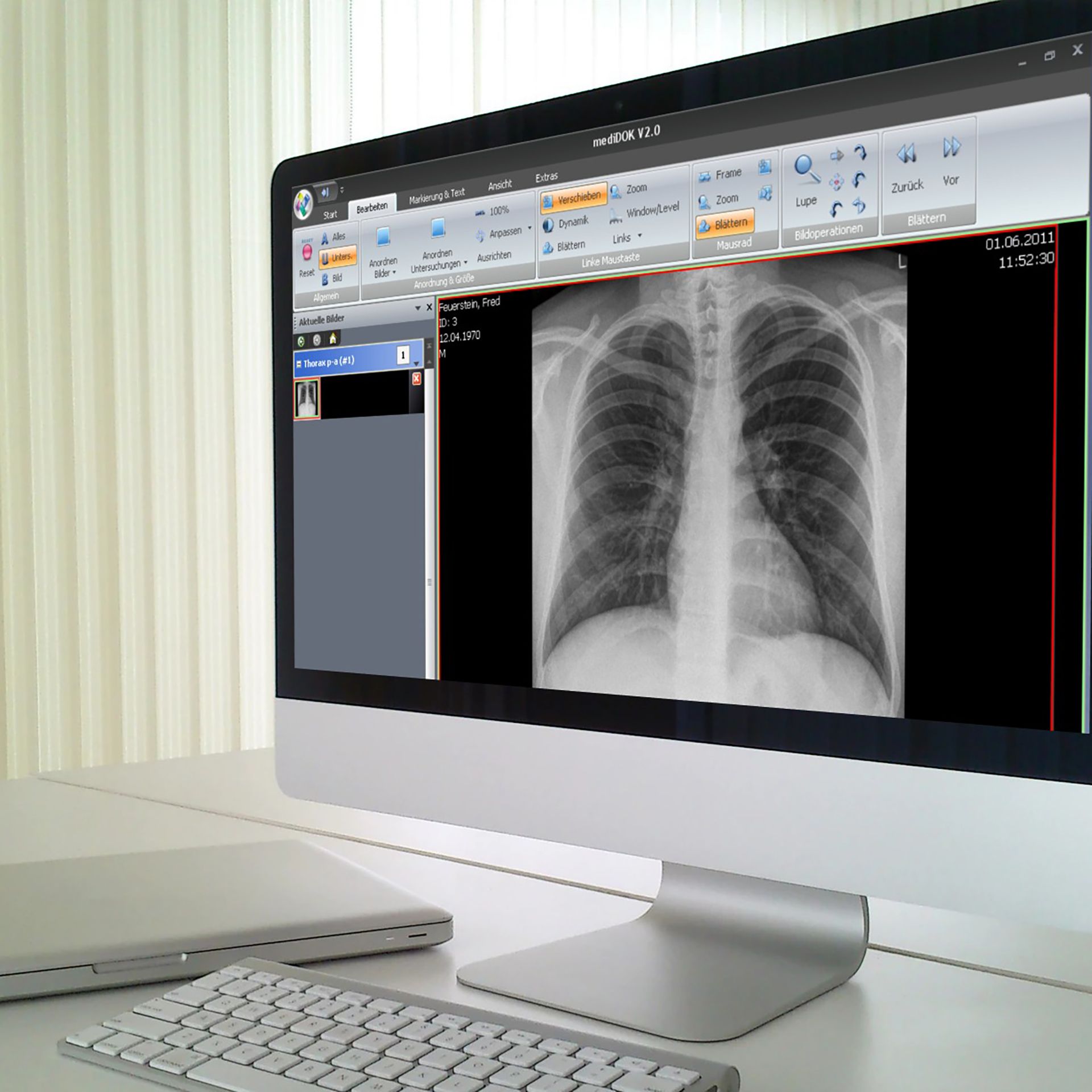 Pacs Software